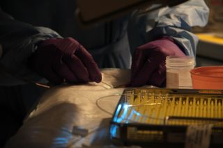 A doctor holds a laser, shining a blue light, during a medical procedure.