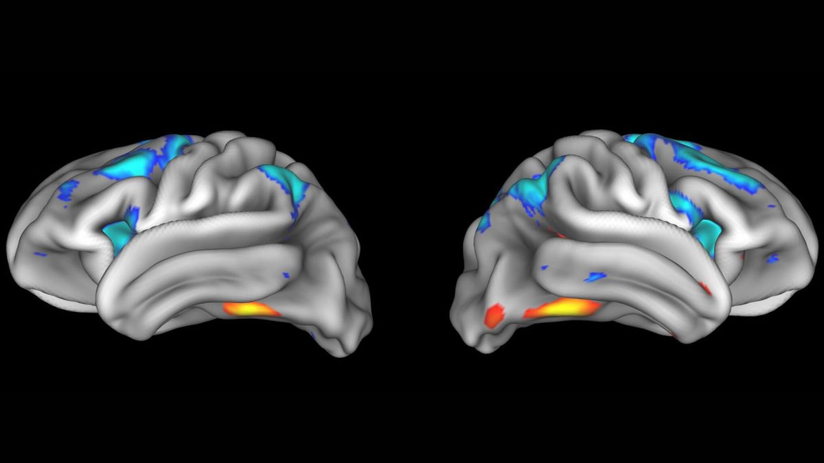 Neuroscience findings often can't be replicated — and it's a big problem for what we know about the brain