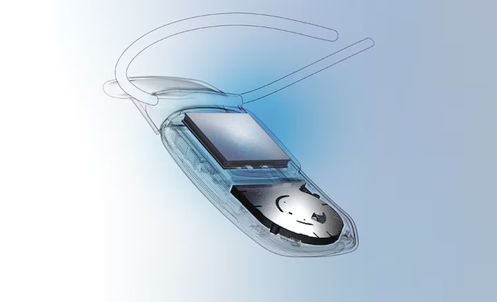 The internals of the Sony Reon Pocket 5