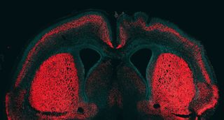 mouse brain with neurons in red