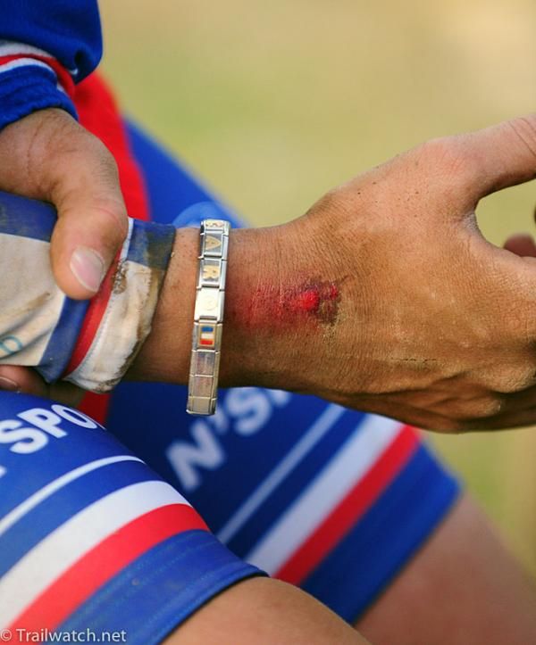 Caroline Mani crashed on the last lap and needed medical attention at the finish