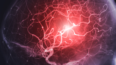 Cerebral angiography image from Fluoroscopy in intervention radiology showing cerebral artery.