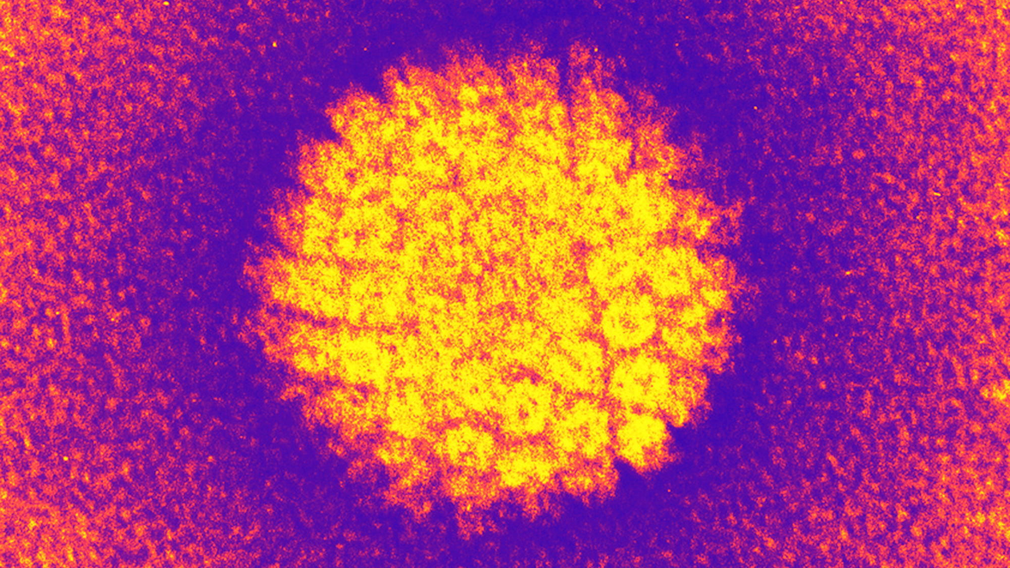 A heat map of a spiky cancer cell against a purple background