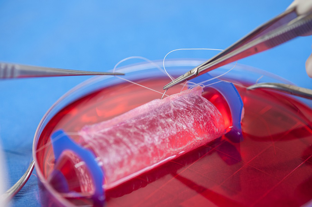 Body Parts Grown In The Lab Live Science