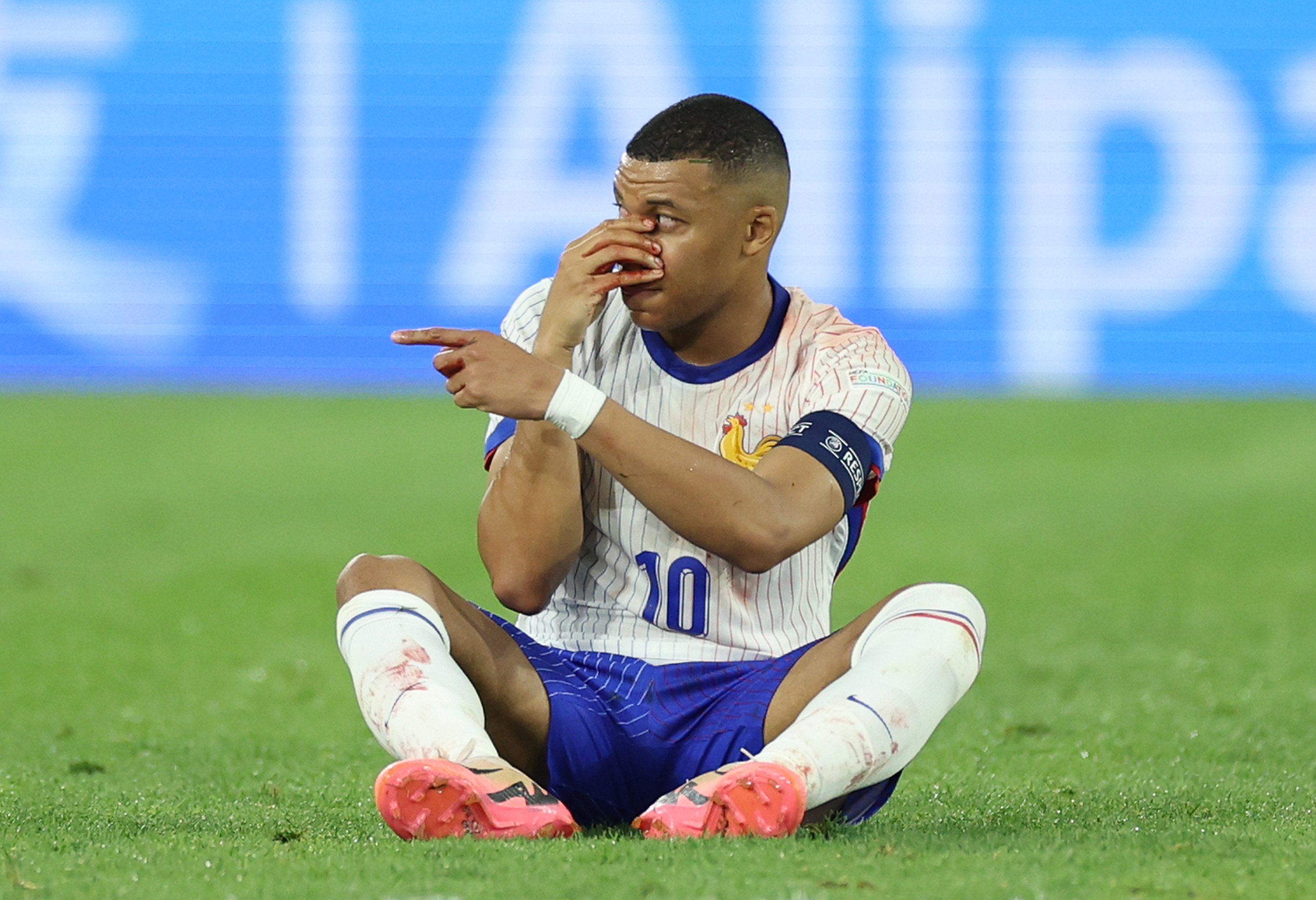 Kylian Mbappe suffered a broken nose against Austria