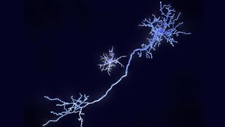 Microglia are specialized immune cells in the brain. In healthy states, they use their arms to test the environment. During an immune response, microglia change shape to engulf pathogens. But they can also damage neurons and their connections that store memory.