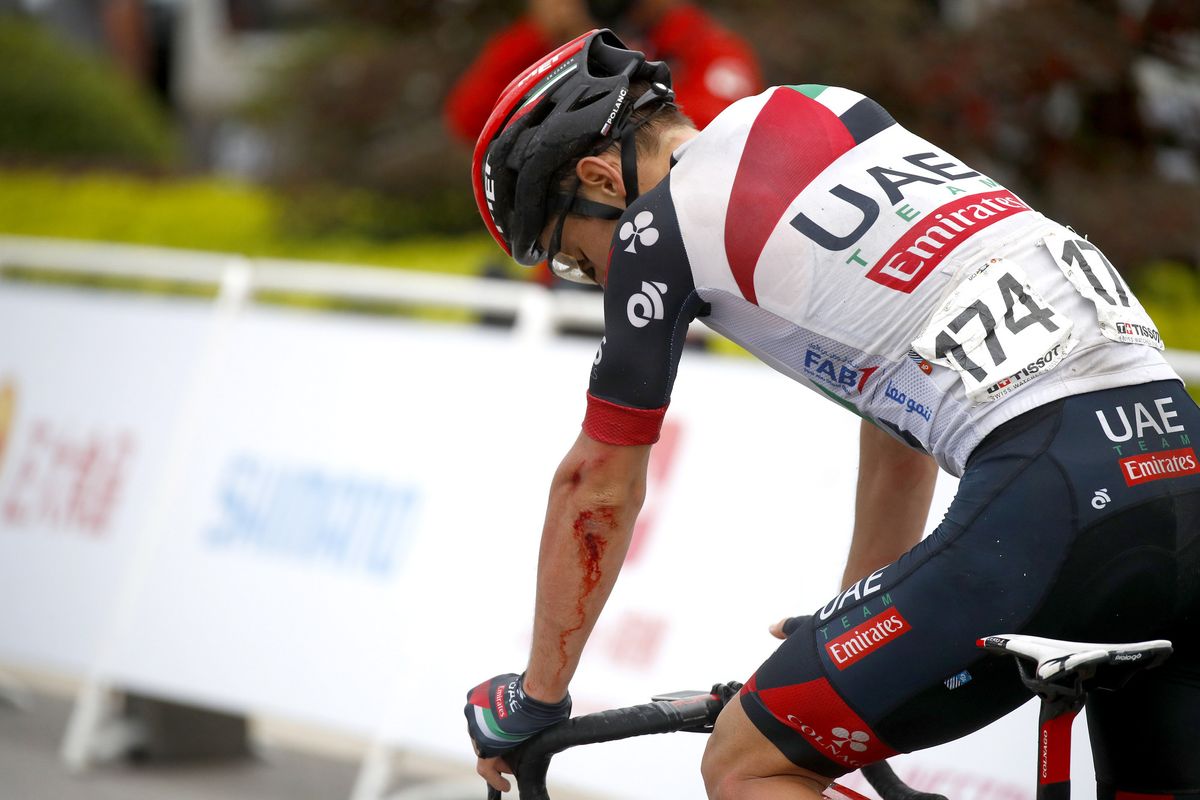 Jan Polanc bloodied after a crash