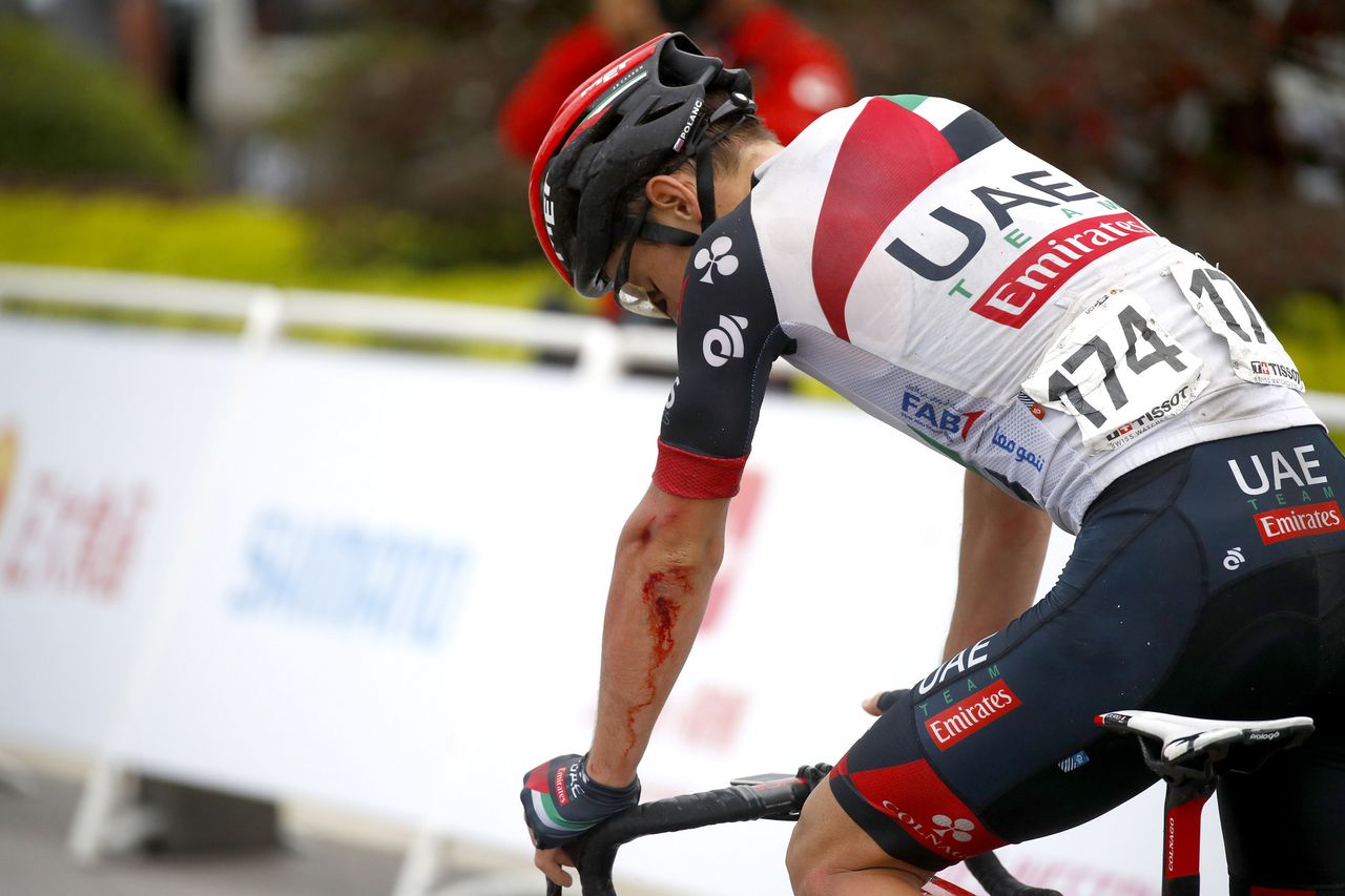 Jan Polanc bloodied after a crash
