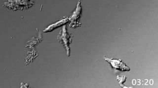 Screenshot from a video showing the amoeba Incendiamoeba cascadensis moving at 60 degrees Celsius (140 degrees Fahrenheit). When pushed to its limits in the lab, I. cascadensis can remain partially active at 150.8 degrees F (66 degrees C) and can recover from exposure to 158 degrees F (70 degrees C) for five minutes. However, 176 degrees F (80 degrees C) proved to be too much for the amoeba to come back from.