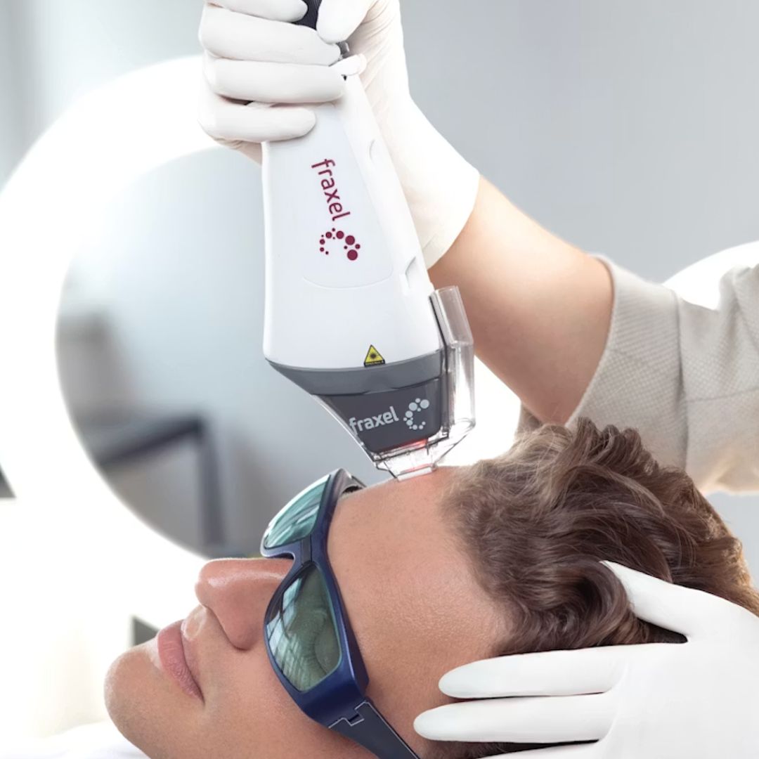 A person receiving fraxel laser treatment