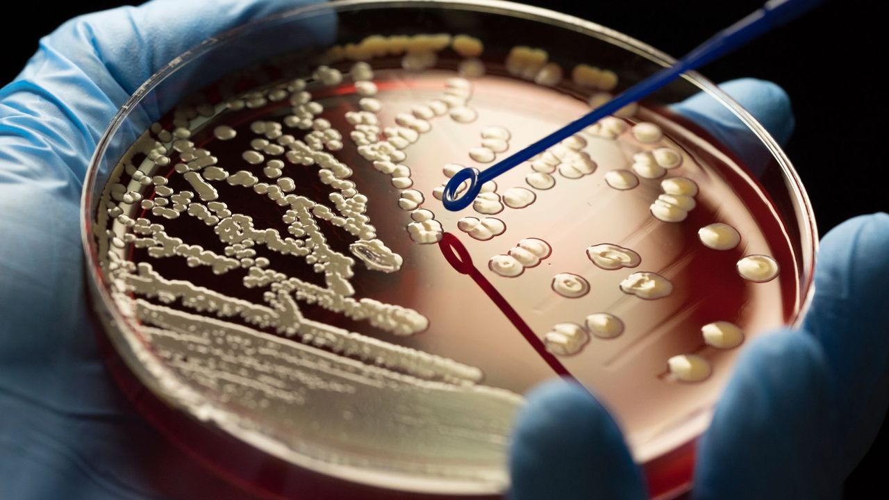 Colonies of MRSA bacteria on blood agar plate