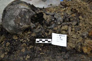 A skull found at the First Baptist Church of Philadelphia's burial ground.