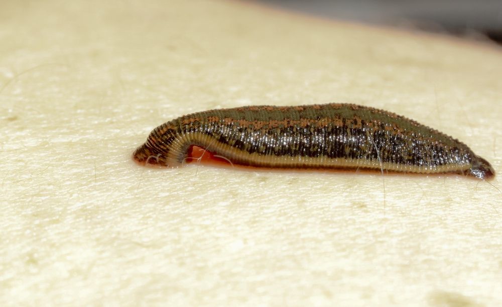 an image of a leech on the skin