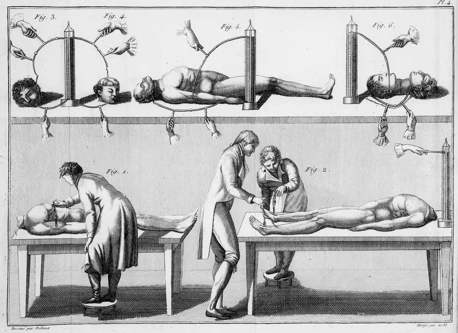 Giovanni Aldini&#039;s experiments with a human corpse.