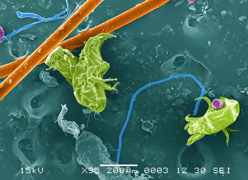 House dust samples carried dust mites, animal fur, fibers and pollen, as seen here in this scanning electron micrograph (SEM).