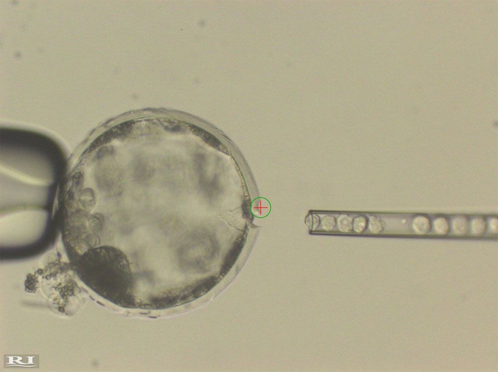 An image of human stem cells being injected into a pig embryo.