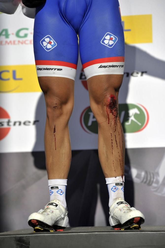 Nacer Bouhanni (FDJ)