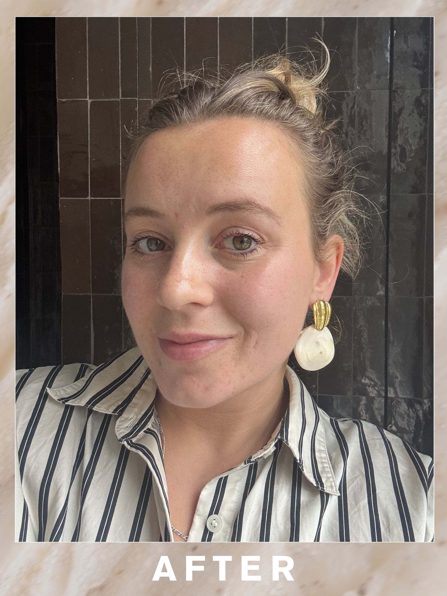 Rebecca after the Augustinus Bader The Elixir Facial