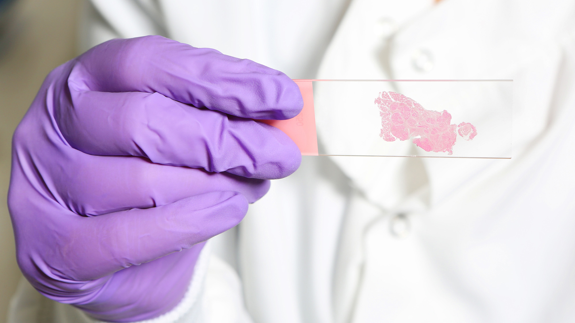 A close up of a purple gloved hand holding a microscope slide with pink cells on it.
