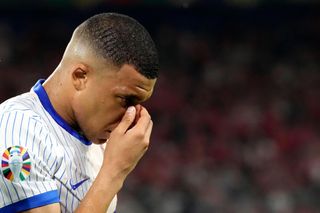 Kylian Mbappe suffered a broken nose at Euro 2024