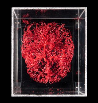 Corrosion cast of brain blood vessels, plastic.