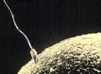 Sperm