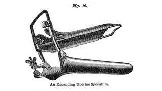 Illustration depicts an expanding uterine speculum, 1895. It was previously published in Dr Ray Vaughn Pierce's 'The People's Common Sense Medical Adviser in Plain English or, Medicine Simplified.'