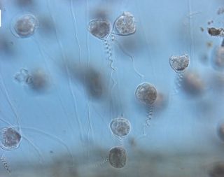 The critter most closely resembled the genus Vorticella, more specifically, Vorticella campanula, whose rapidly contracting stalk was found to be one of the world's fastest cellular engines.