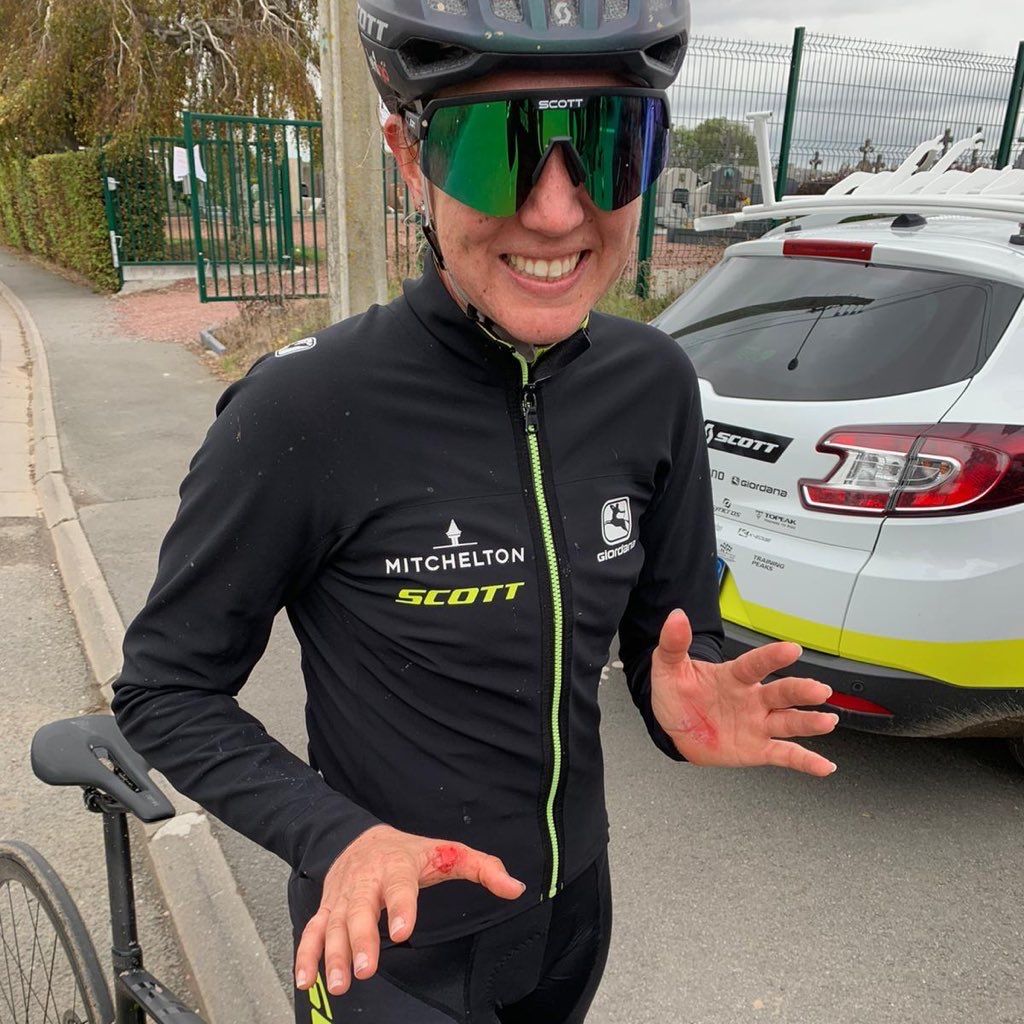 Blistered hands after the Paris-Roubaix recon