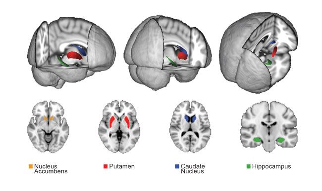 Size of Brain Region Affects Video Game Performance