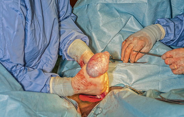 1-castration-F07C9J.jpg