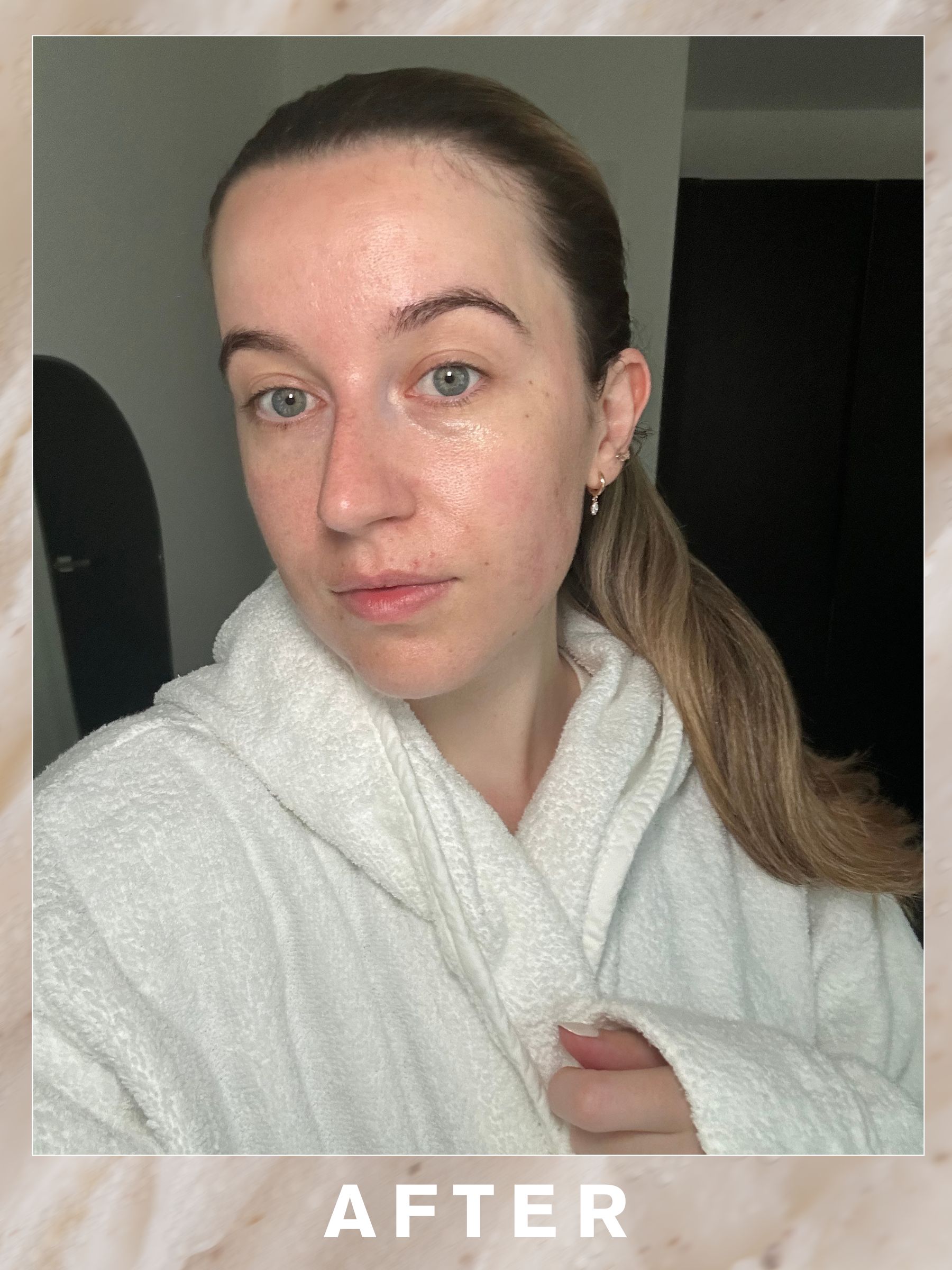 Grace after Sarah Chapman barrier repair facial