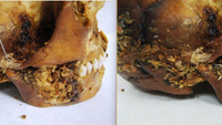 two side views of a partially mummified human skull