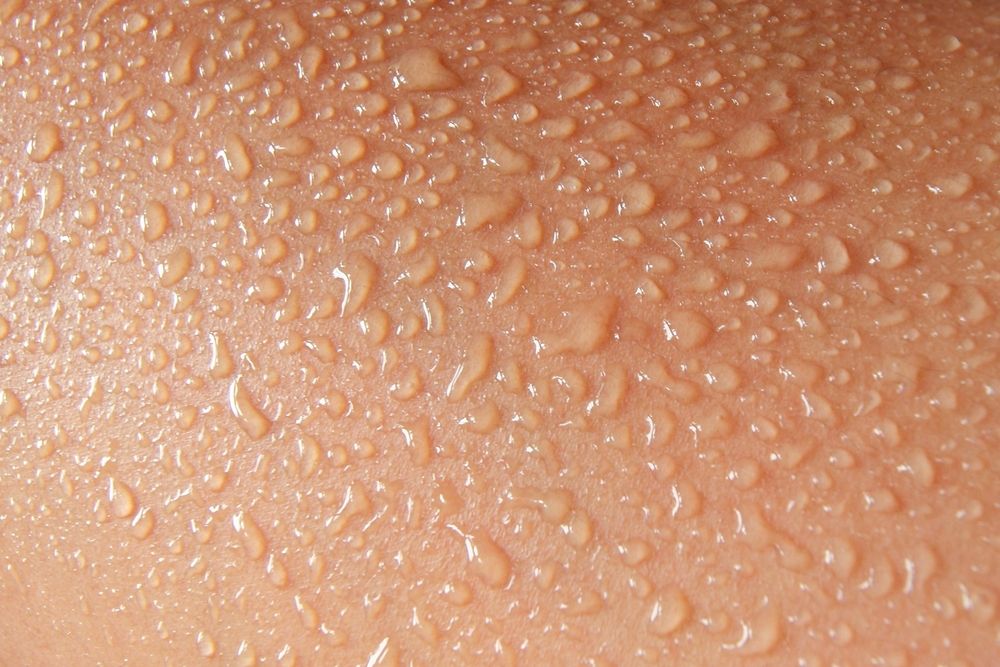 excessive-sweating-this-rare-genetic-condition-could-be-the-cause