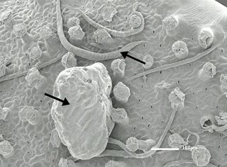 This scanning electron microscope image shows the upper leaf surface several nematodes (arrows), stalked glands, and adherent sand grains (arrows).