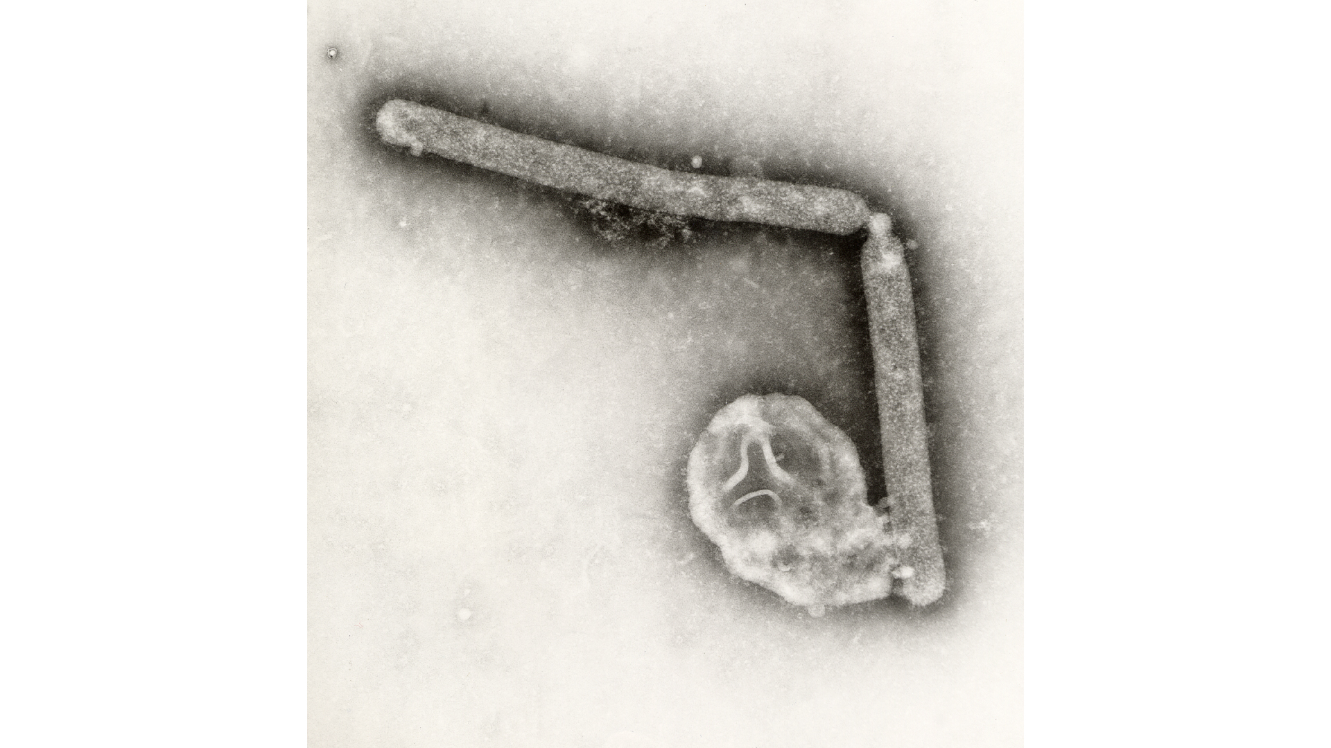 Black and white microscopic image of bird flu virus particles