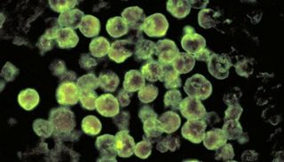 naegleria-fowleri-11081902