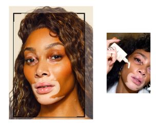 Kein Filter mit Winnie Harlow