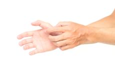 scratching itch