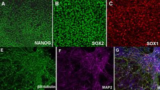 induced pluripotent stem cells