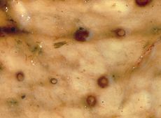 EncystedSmallRedworms.jpg