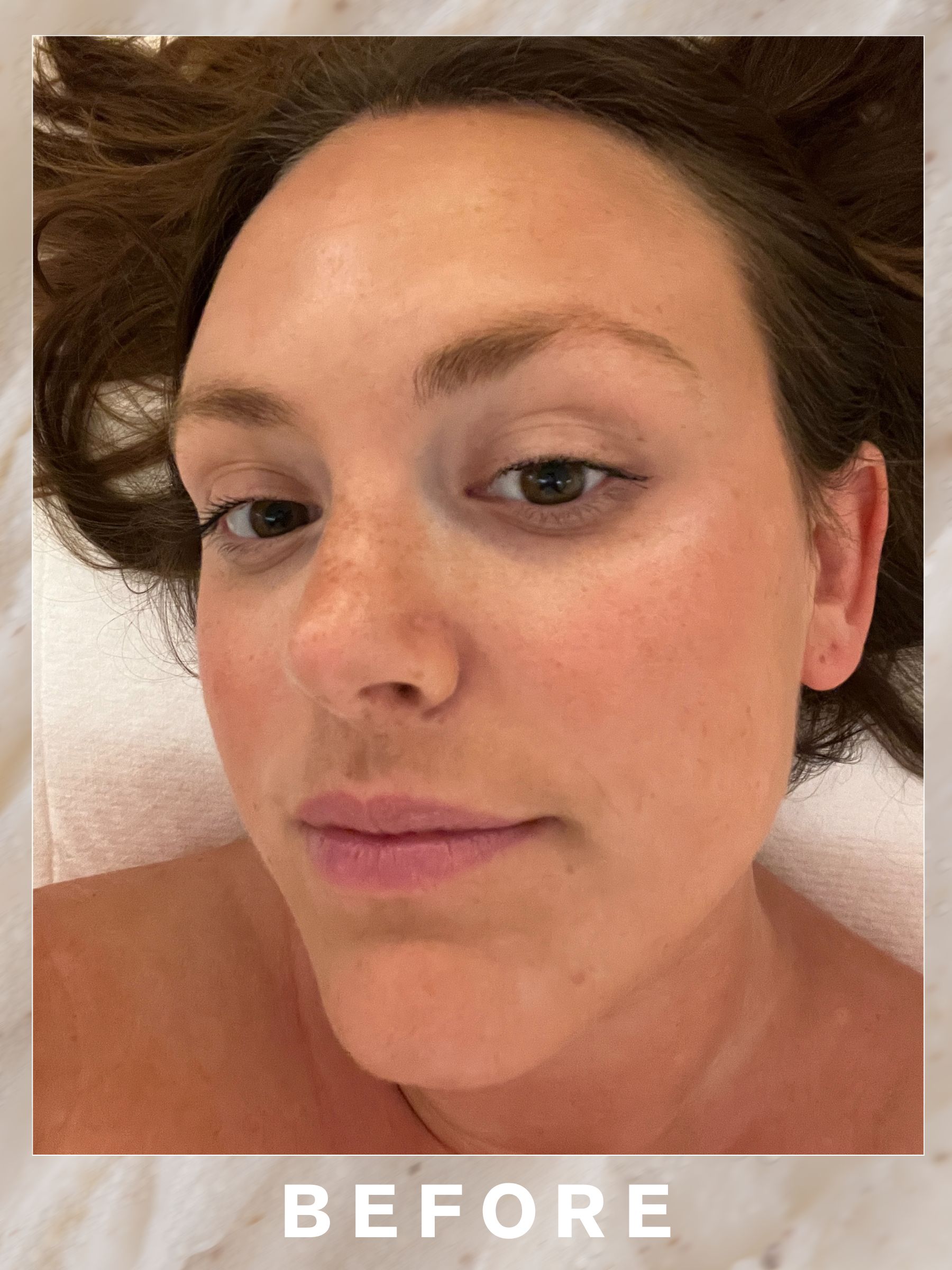 Poppy before her Sunday Riley Ice Lift Facial