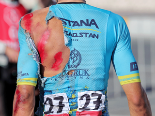Road rash on Harold Tejada's back after the high-speed crash at the UAE Tour