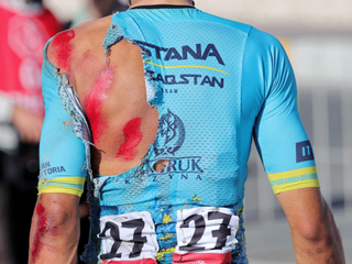 Road rash on Harold Tejada&#039;s back after the high-speed crash at the UAE Tour