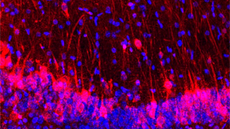 Microscopic image of mouse and rat brain cells shows cells labeled in red and blue on dark background