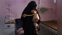 A woman dressed in a Burka holds an emaciated child in her arms.