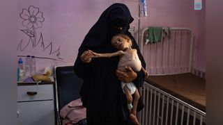 A woman dressed in a Burka holds an emaciated child in her arms.