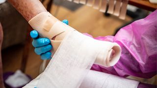 photo shows the gloved hands of a nurse wrapping a child&#039;s foot in gauze and bandages; the child&#039;s exposed ankle has patches of discoloration and skin wounds