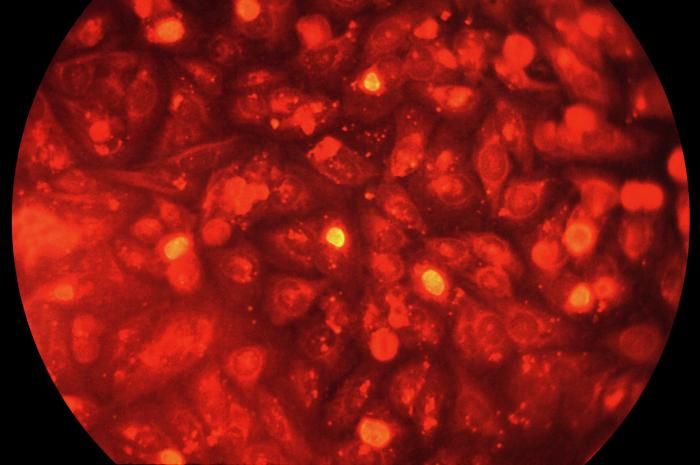 This picture shows HeLa cells growing in a lab dish, infected for the purposes of research with the pathogen that causes Chlamydia.