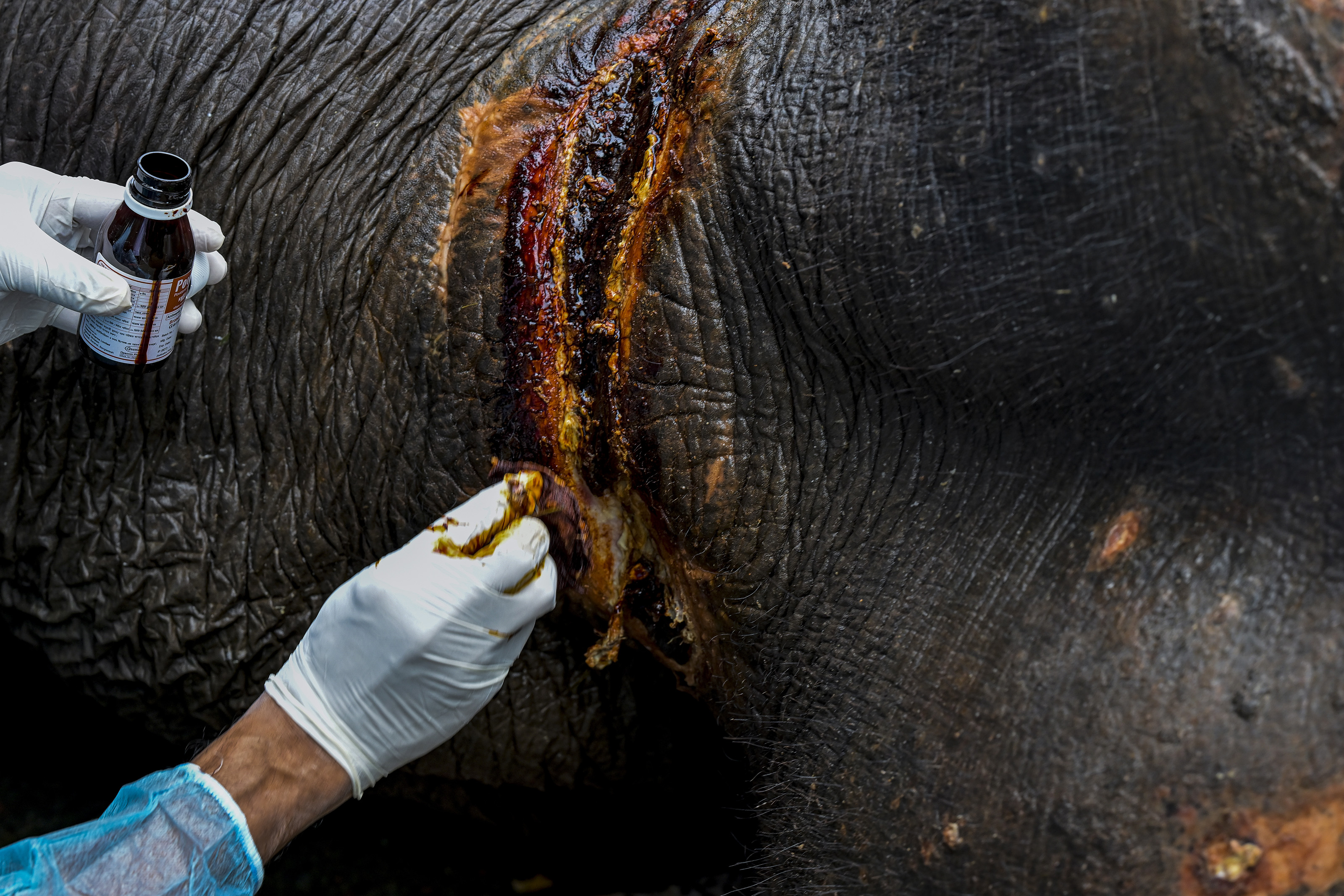 Rescue of Badsha Bahadur, a circus elephant, was transferred to the Bangladesh National Zoo in Mirpur after a video showing his deteriorating health circulated on social media. The elephant is now undergoing treatment and remains under close observation by veterinary specialists in Dhaka, Bangladesh, on 15 July 2026. Badsha Bahadur, the 55-year-old circus elephant, marks a welcome step towards better wildlife welfare. After a video showing his deteriorating health circulated on social media, authorities rescued him from Naogaon. She is expected to receive veterinary care, proper nutrition, and much-needed rest. According to officials, the elephant had an injured leg, a broken tusk with an infection, and an owner who could no longer afford the cost of his treatment and upkeep. (Photo by Zabed Hasnain Chowdhury/NurPhoto via Getty Images)